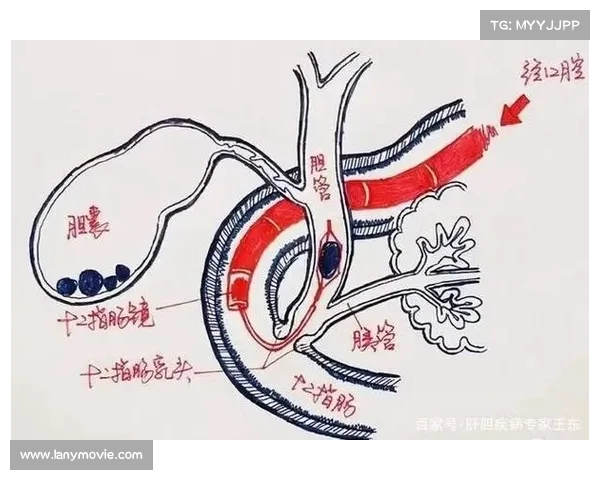 沧州传染病医院肝硬化治疗收费详解
